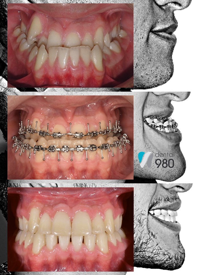 Dental 980