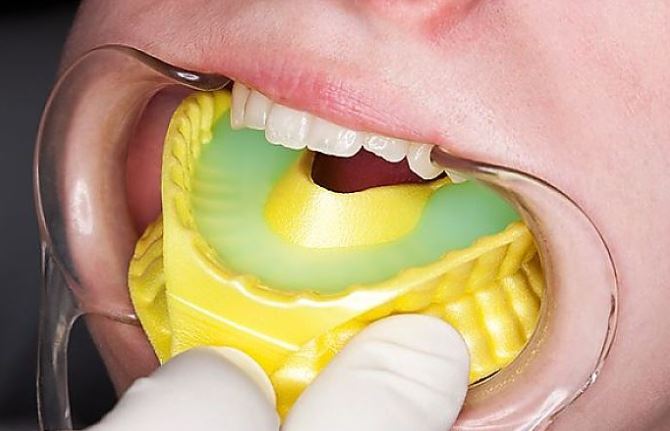 ProGental - Dental Higiene Specialist