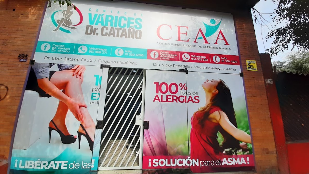 Specialized Center varices